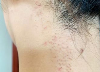 [新闻]191120 女艺人敬业不容易啊！杨紫回应现身美容医院实为进组准备